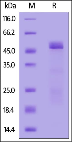 ACROBiosystems Mouse MMP-2 (30-460), His Tag (MM2-M52H9) is expressed from