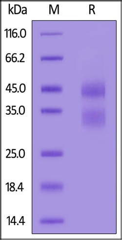 ACROBiosystems Mouse Cathepsin B, His Tag (CTB-M52H9) is expressed from