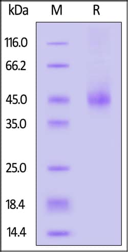 ACROBiosystems Human TSH alpha/beta Heterodimer, His Tag (TSR-H52W8) is