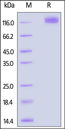 ACROBiosystems Human OSMR, His Tag (OSR-H52H9) is expressed from human