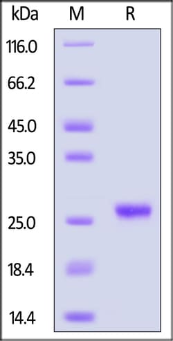 ACROBiosystems Cynomolgus Lipocalin-2, His Tag (LC2-C5223) is expressed