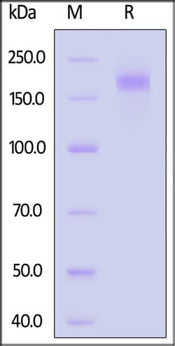 ACROBiosystems SARS-CoV BtKY72 Spike Trimer, His Tag (SPN-S52Hu) is expressed