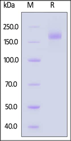 ACROBiosystems Bat coronavirus HKU3 (BtCoV) (SARS-like coronavirus HKU3)