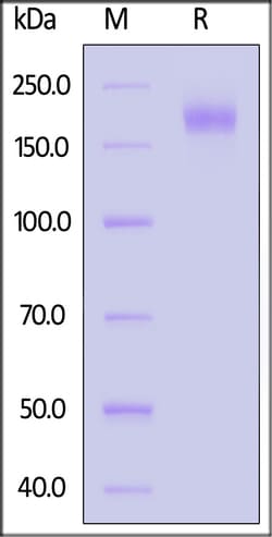 ACROBiosystems Bat coronavirus BM48-31/BGR/2008 Spike Trimer, His Tag (SPN-B52H9)