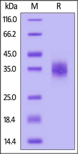 ACROBiosystems Human CLEC4C, His Tag (CLC-H5245) is expressed from human
