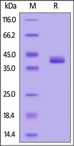 ACROBiosystems Biotinylated Human APOE3 (R154S), His,Avitag (APE-H52E4)