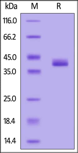 ACROBiosystems Biotinylated Human APOE3 (R154S), His,Avitag (APE-H52E4)