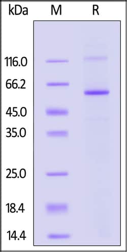 ACROBiosystems Human MAOB, His Tag (MAB-H5547) is expressed from Baculovirus-Insect