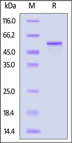 ACROBiosystems Human GFAP, His Tag (GFP-H5143) is expressed from E.coli