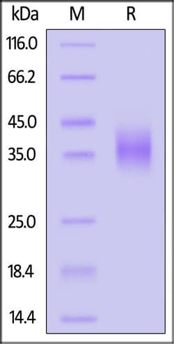 ACROBiosystems Human uPAR (112-303), His Tag (UPR-H52H4) is expressed from