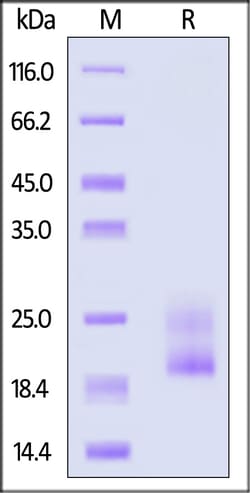 ACROBiosystems Human TRBC1, His Tag (TR1-H52H4) is expressed from human