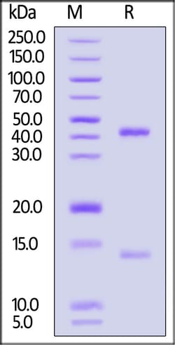 ACROBiosystems Biotinylated Human HLA-A*0201 WT-1 (RMFPNAPYL) Complex Protein