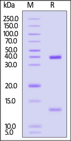 ACROBiosystems Biotinylated Human HLA-A*0201 Glycipan 3 (FVGEFFTDV) Complex