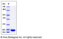 Sino Biological Recombinant Rhesus IL-1 beta Protein, Quantity: Each of