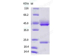 Sino Biological Recombinant Human IL-23 Protein (His Tag), Quantity: Each