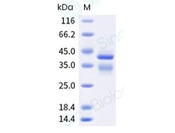 Sino Biological Recombinant Human IL-12 Protein, HPLC-verified, Quantity: