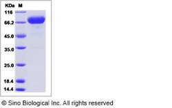 Sino Biological Recombinant Human IL-12 Protein (His Tag), Quantity: Each