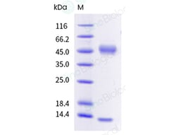 Sino Biological Recombinant Mouse FCGRT & B2M Heterodimer Protein (His