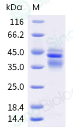 Sino Biological Recombinant Human IL-12 Protein (His Tag), HPLC-verified,