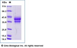 Sino Biological Recombinant Human IL-12 Protein (His Tag), Amine-Labeled