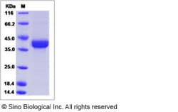 Sino Biological Recombinant Rat CD3 epsilon/CD3e Protein (hFc Tag), Quantity: