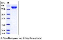 Sino Biological Recombinant Human Butyrylcholinesterase Protein (His Tag),
