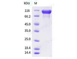 Sino Biological Recombinant Cynomolgus Her2/ERBB2 Protein (His Tag), HPLC-verified,