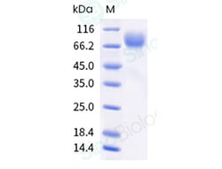 Sino Biological Recombinant Cynomolgus B7-H3 Protein (ECD, His Tag), HPLC-verified,