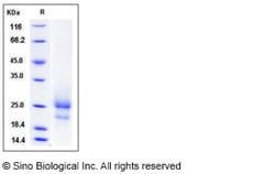 Sino Biological Recombinant Mouse TSLP Protein (His Tag), Quantity: Each