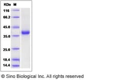 Sino Biological Recombinant Human QPCT Protein (His Tag), Quantity: Each