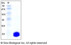 Sino Biological Mouse S100A6 Protein 50ug, Quantity: Each of 1