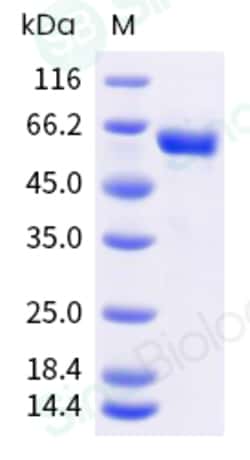 Sino Biological Recombinant Cynomolgus, Rhesus CD39/ENTPD1 Protein (His