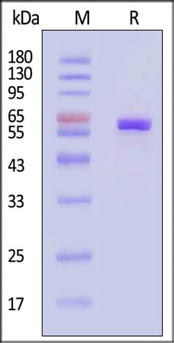 ACROBiosystems Human ALPP Protein, His Tag, Quantity: Each of 1