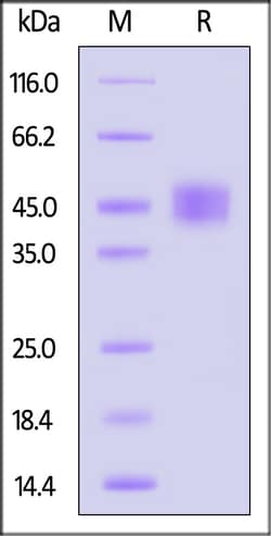 ACROBiosystems Biotinylated Cynomolgus Carbonic Anhydrase XII Protein,