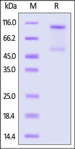 ACROBiosystems Human E-Cadherin / Cadherin-1 (155-709) Protein, Fc Tag,