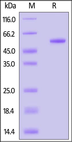ACROBiosystems Biotinylated Human IL-17B Protein, Fc,Avitag (MALS verified),