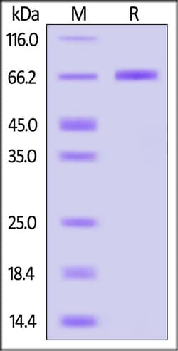 ACROBiosystems Human TNFR2 / CD120b / TNFRSF1B Protein, Fc Tag (MALS verified),