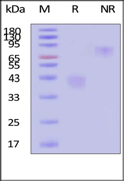ACROBiosystems Human M-CSF / CSF-1 Protein, premium grade, Quantity: Each