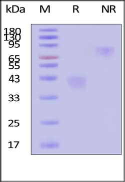 ACROBiosystems Human M-CSF / CSF-1 Protein, premium grade, Quantity: Each