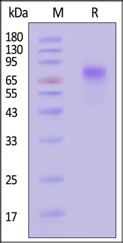 ACROBiosystems Rotavirus A VP4 Protein, His Tag (MALS verified), Quantity: