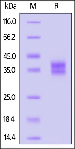 ACROBiosystems Cynomolgus IL-2 R beta / CD122 Protein, His Tag (MALS verified),