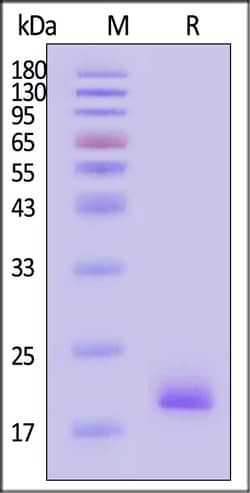 ACROBiosystems Biotinylated Human TNF-alpha Protein, His,Avitag , active