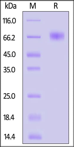 ACROBiosystems Cynomolgus Coagulation factor IX / F9 Protein, His Tag (active