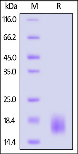 ACROBiosystems Mouse TSPAN8 Protein, His Tag (MALS verified), Quantity: