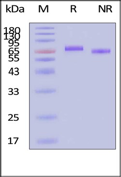 ACROBiosystems ActiveMax Human IL-12 Protein, Tag Free (MALS verified),