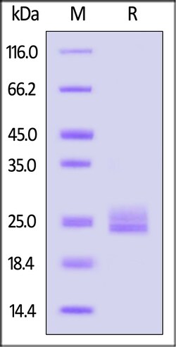 ACROBiosystems Human Claudin-6 / CLDN6 Protein, His,Twin-Strep Tag (Nanodisc),