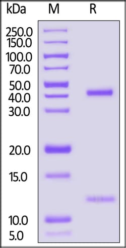 ACROBiosystems Biotinylated Human HLA-A*02:01&B2M&AFP (FMNKFIYEI) Complex