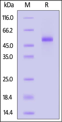 ACROBiosystems Biotinylated Cynomolgus DLL3 Protein, His,Avitag, Quantity: