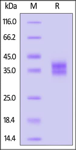 ACROBiosystems Cynomolgus IL-2 R beta / CD122 Protein, His Tag (MALS verified),