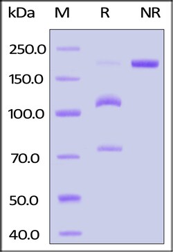 ACROBiosystems Biotinylated Human Complement C5 Protein, His,Avitag, Quantity:
